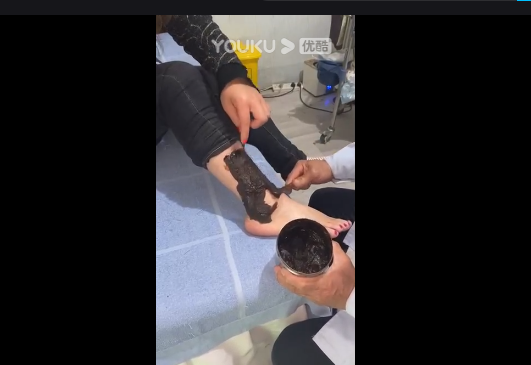 治疗视频